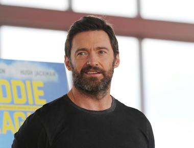 Hugh jackman lost considerable weight for les mis rables and went 36 hours without water causing him to lose water weight around his eyes and cheeks giving him the gaunt appearance of a prisoner