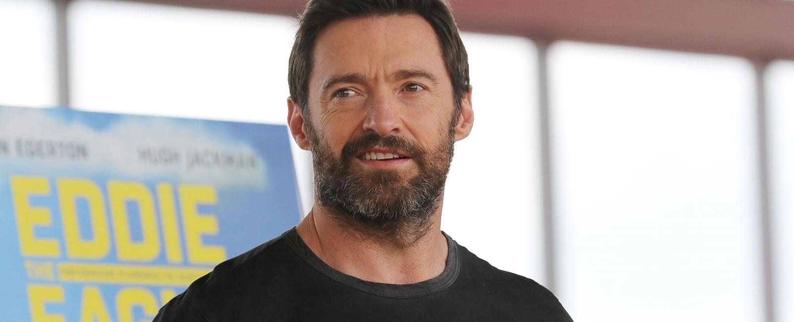 Hugh jackman lost considerable weight for les mis rables and went 36 hours without water causing him to lose water weight around his eyes and cheeks giving him the gaunt appearance of a prisoner