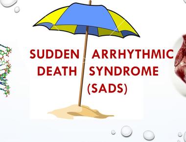 Sudden arrhythmic death syndrome is a condition where someone seemingly healthy dies suddenly with no apparent cause of death