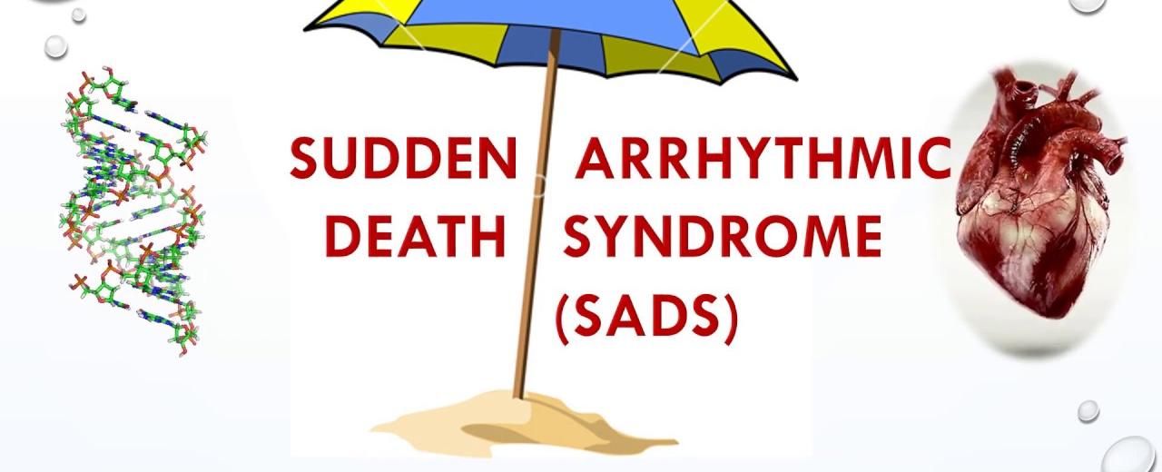 Sudden arrhythmic death syndrome is a condition where someone seemingly healthy dies suddenly with no apparent cause of death