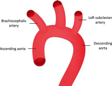 The aorta which is the largest artery in the body is about the diameter of a garden hose