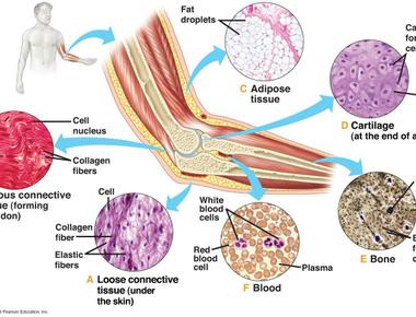 There is a connective tissue disease that turns your muscles into bones