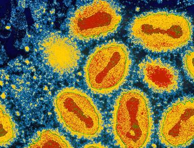 In 5 000 years of human history only one disease has been eradicated smallpox