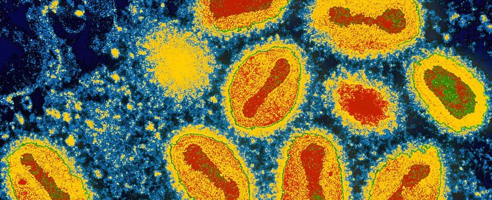 In 5 000 years of human history only one disease has been eradicated smallpox