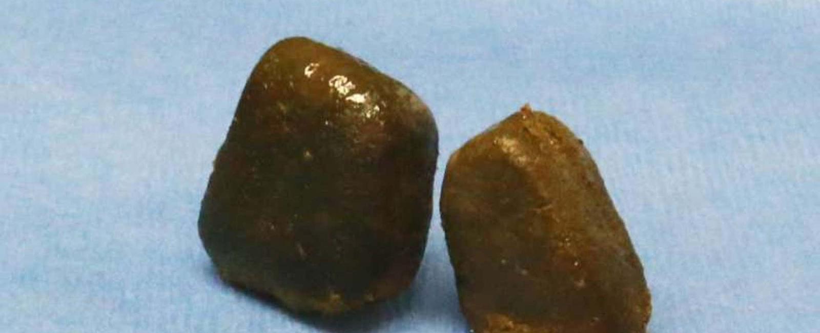 Wombat poop is cube shaped