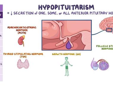 Some individuals who claim never to have felt romantic love suffer from hypopituitarism a rare disease that doesn t allow a person to feel the rapture of love