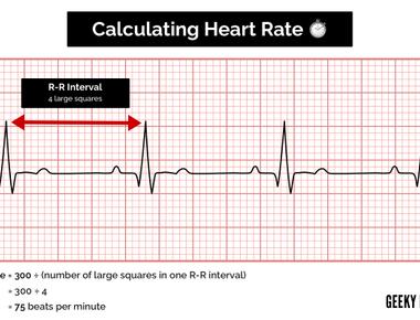 The normal heart rate for a human is 70 100 beats per minute