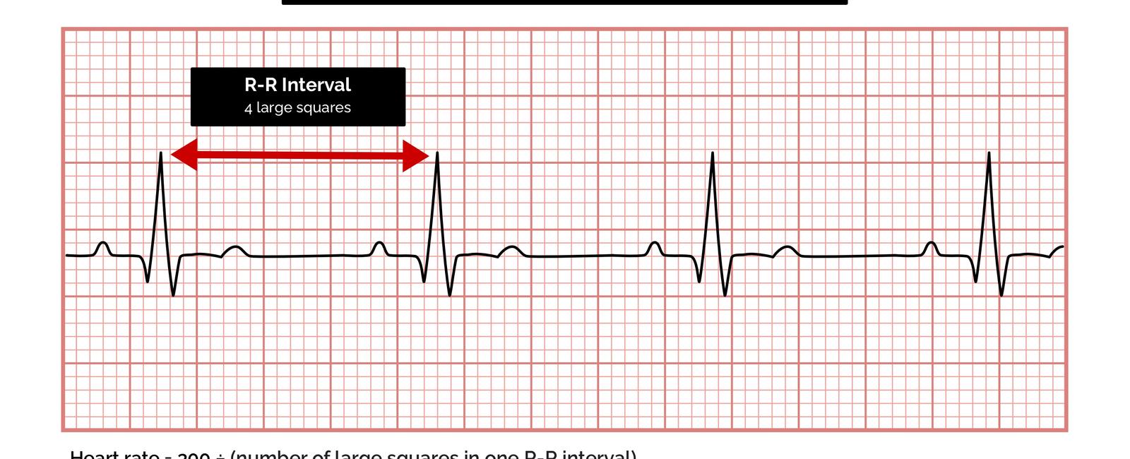 The normal heart rate for a human is 70 100 beats per minute