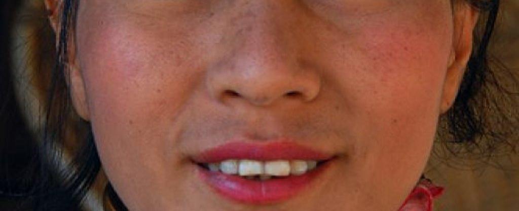 The longest human necks extend to 7 7 inches belonging to women in the padaung tribe in the highlands of northwestern thailand