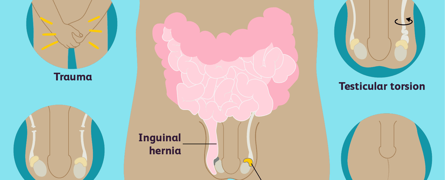 The left testicle usually hangs lower than the right for right handed men the opposite is true for lefties