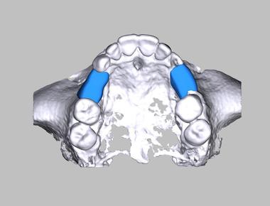 A block of human bone the size of a matchbox can support up to 18 000 pounds of weight