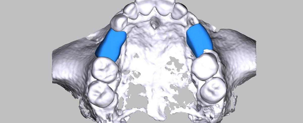 A block of human bone the size of a matchbox can support up to 18 000 pounds of weight