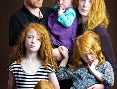 Scotland has more redheads than any other part of the world