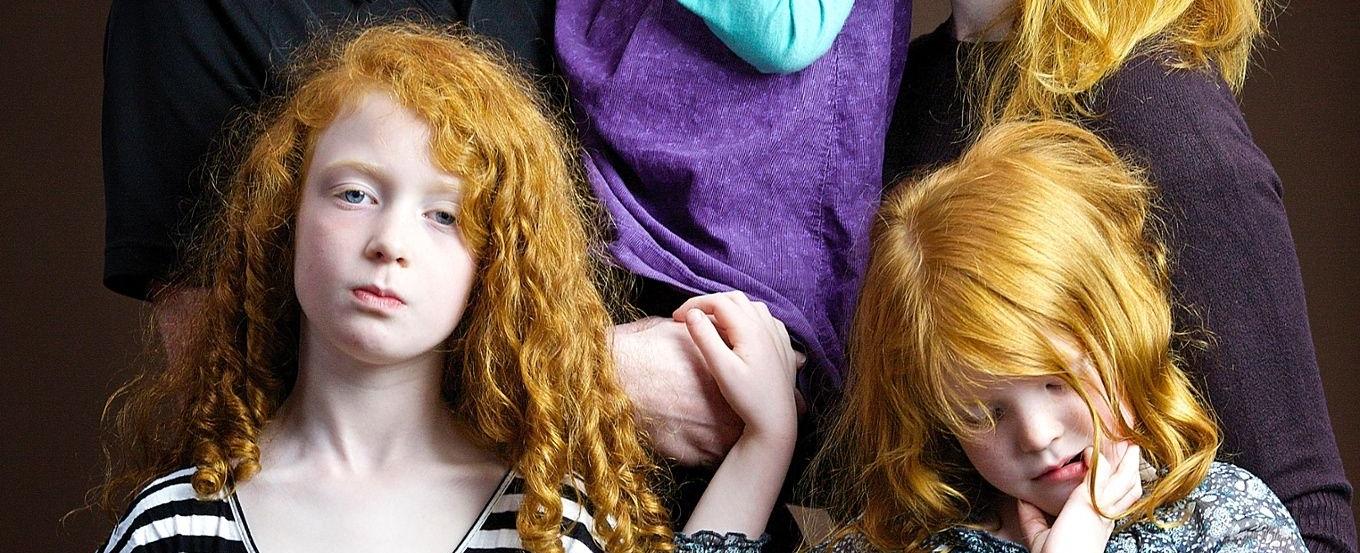 Scotland has more redheads than any other part of the world