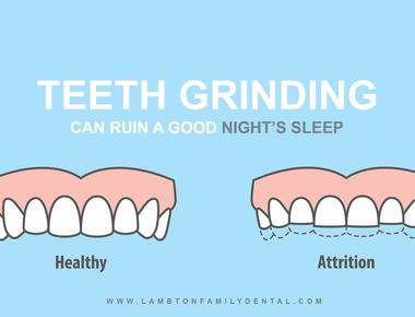 One in eight men snores while one in ten grinds his teeth