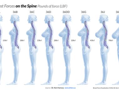 One female breast is usually 1 5 cup size larger than the other