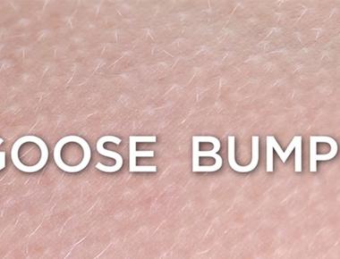 Dead people can get goose bumps