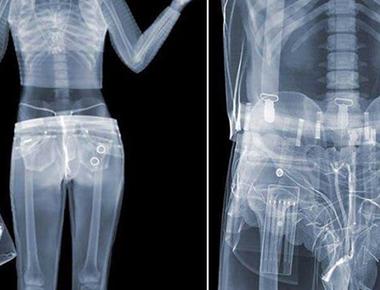 Under very special and dangerous conditions you can actually see x rays