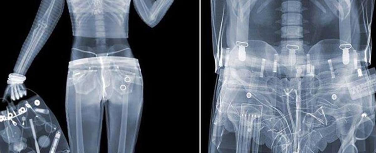 Under very special and dangerous conditions you can actually see x rays