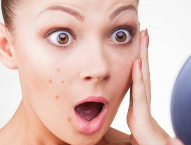 Turn the shower to cold before you get out it closes your pores and makes you less likely you get acne