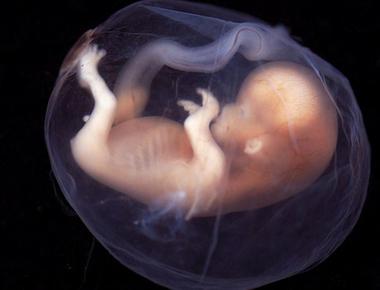 A fetus can be seen yawning around 11 weeks after conception