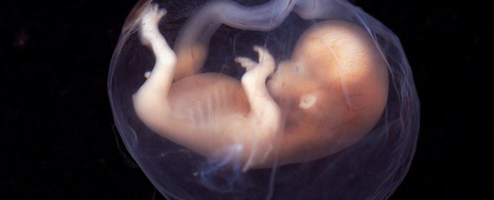 A fetus can be seen yawning around 11 weeks after conception