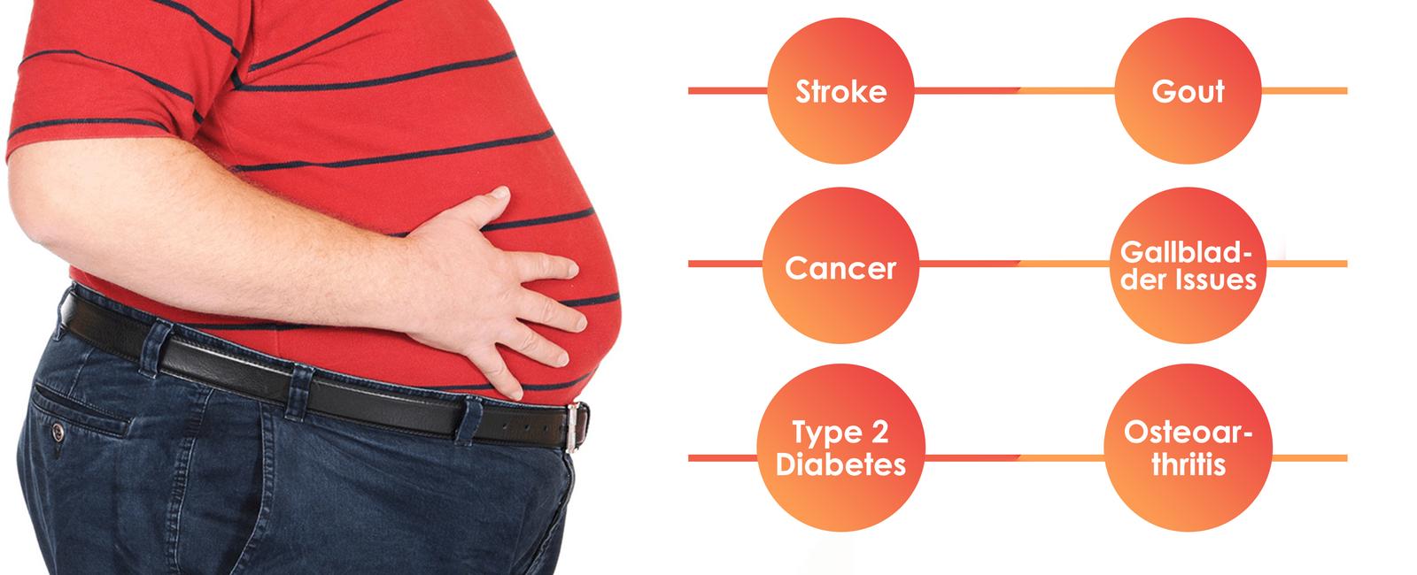 Obesity can increase the chances of developing diseases such as type 2 diabetes and heart disease