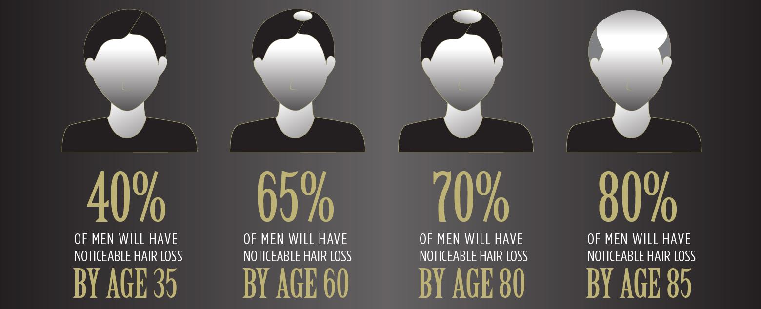 An average human loses about 200 head hairs per day