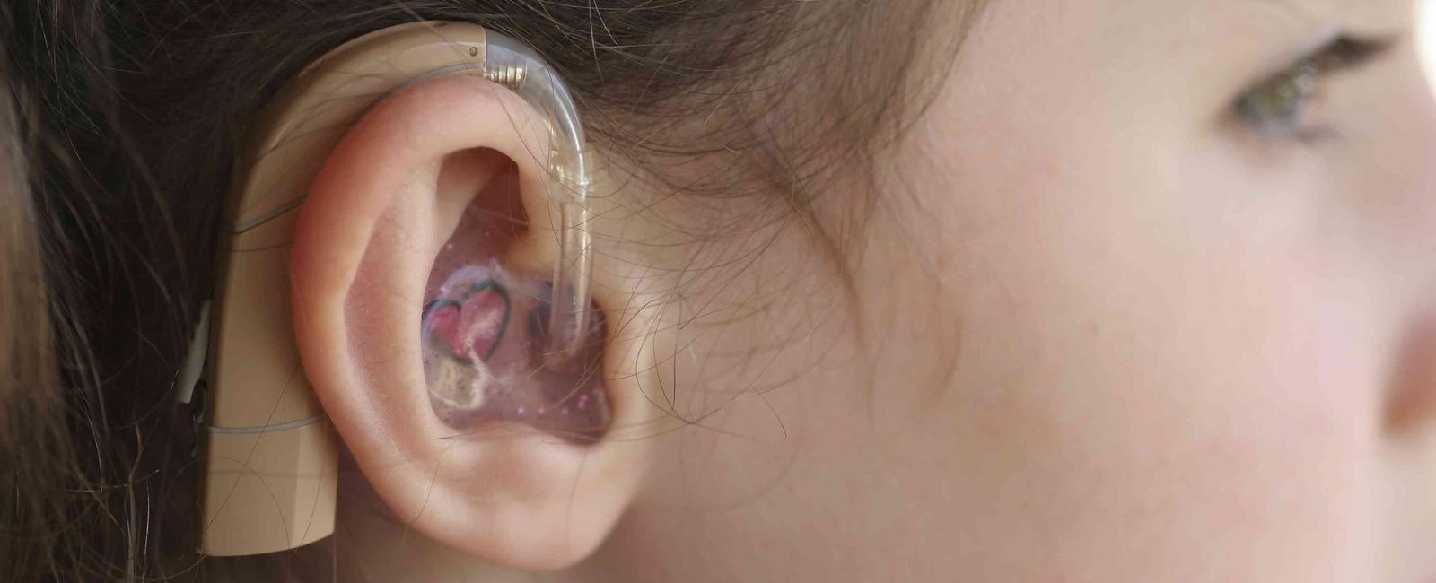 Babies and small children are most vulnerable to hearing loss due to their small ear canals