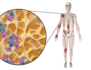 Your skin cells get replaced every 2 3 weeks your bones and fat cells regenerate every 10 years however your brain cells eyes and tooth enamel stay the same for life