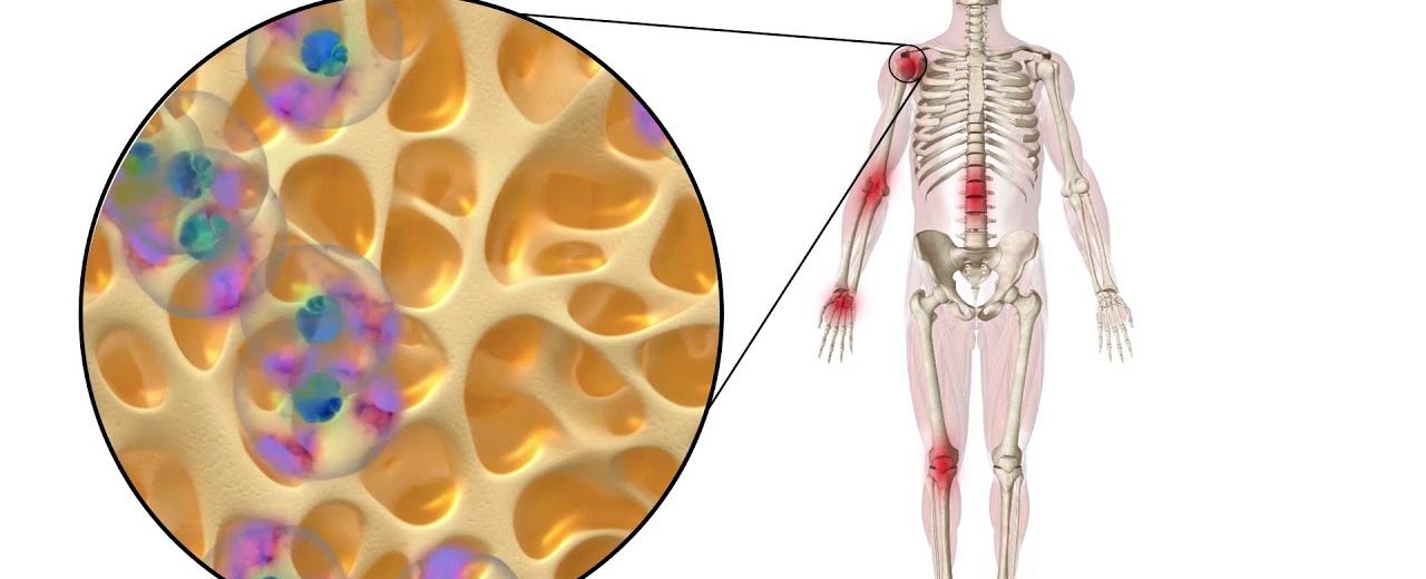 Your skin cells get replaced every 2 3 weeks your bones and fat cells regenerate every 10 years however your brain cells eyes and tooth enamel stay the same for life