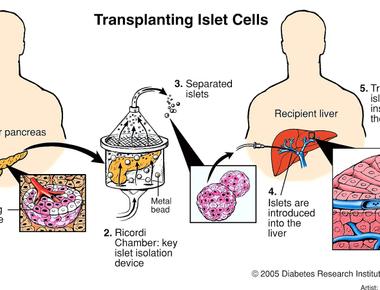 The pancreas produces insulin