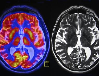 Brain imaging research on women has shown that sensory signals from the nipples end up in the same area of the brain that stimulation from the vagina cervix and clitoris do