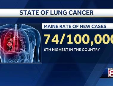 Every year in the united states there are 178 000 new cases of lung cancer