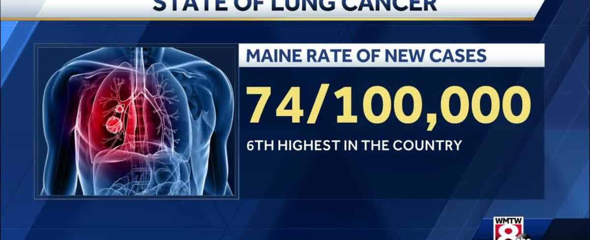 Every year in the united states there are 178 000 new cases of lung cancer