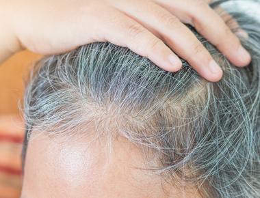 The graying of hair is attributed to genetic defects hormones body distribution age climate pollutants toxins and chemical exposure