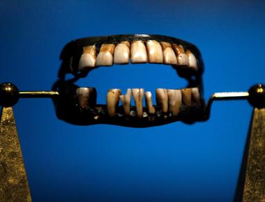 Before dentures were invented teeth were extracted from the mouths of dead soldiers for use as prosthetics