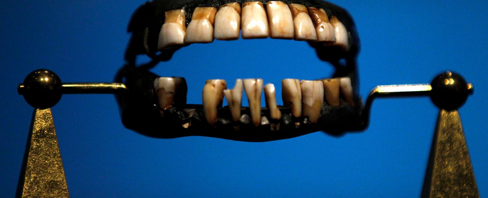 Before dentures were invented teeth were extracted from the mouths of dead soldiers for use as prosthetics