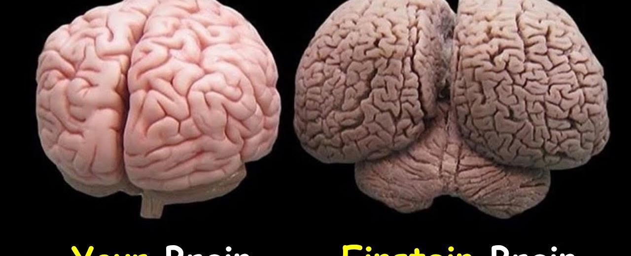 Canadian researchers have found that einstein s brain was 15 wider than normal