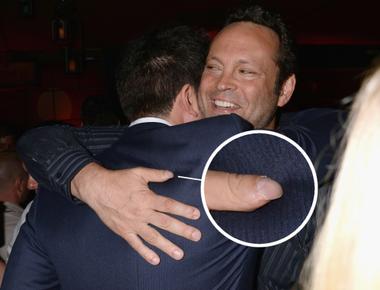 Matthew perry lost part of his middle finger in a car door