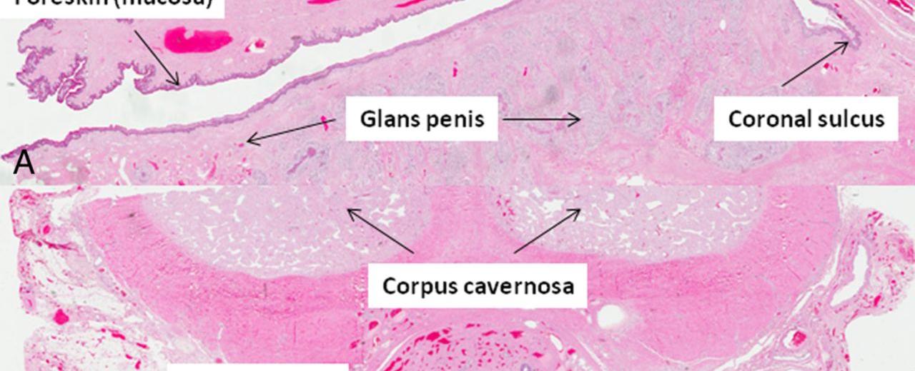 A clitoris is made of the same spongy tissue as a penis and just like the male penis the clitoris fills with blood and expands when aroused