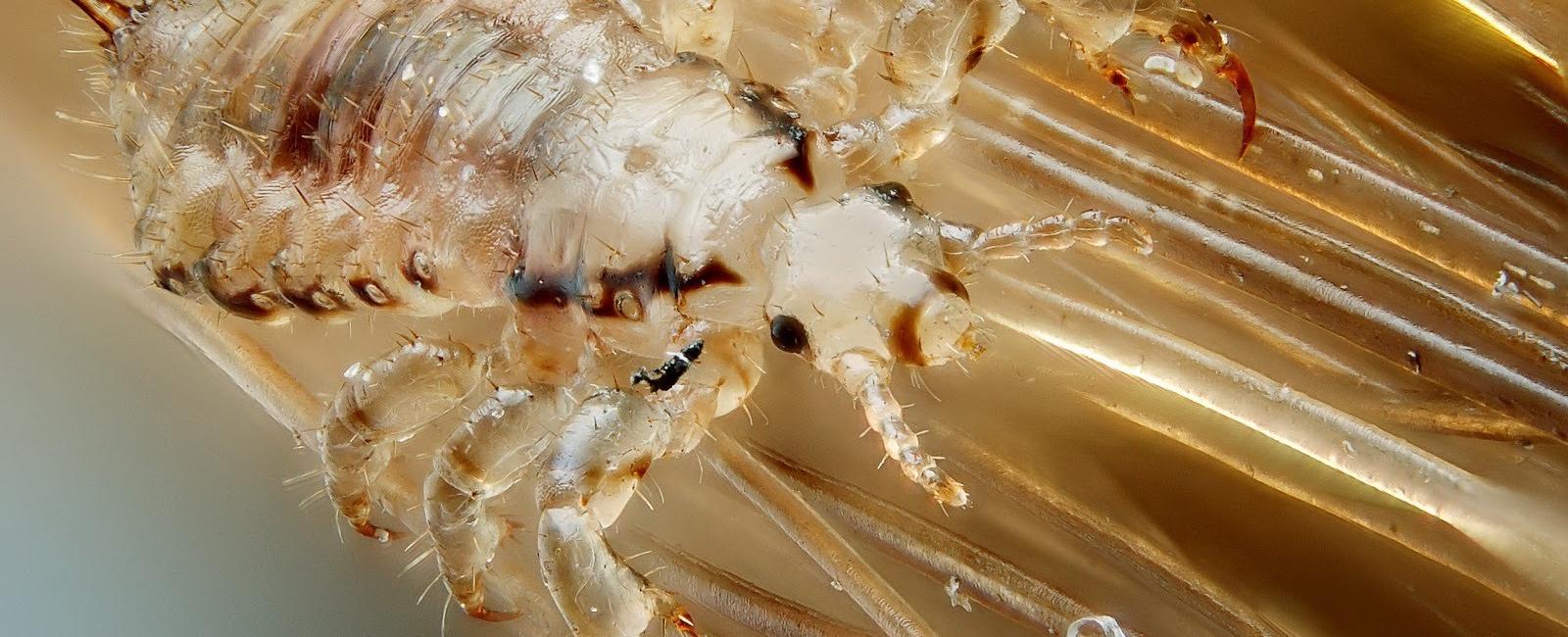 The sexually transmitted disease known as crabs is actually just pubic lice stuck inside the hair follicles of the genitalia