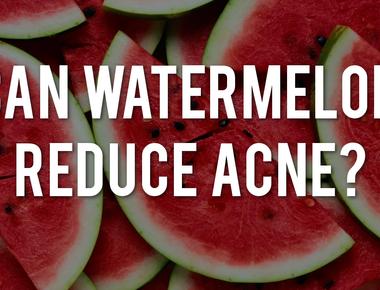 Eating watermelon can help reduce acne breakouts and keep skin healthier