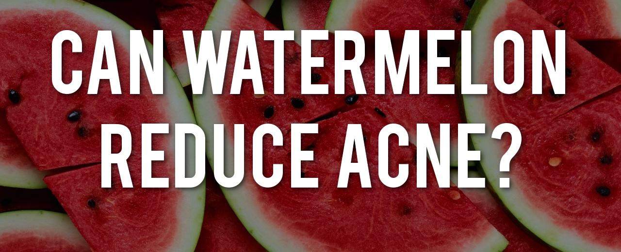 Eating watermelon can help reduce acne breakouts and keep skin healthier