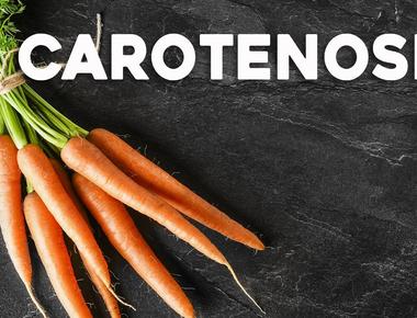 Carrots can turn you orange if you eat several three or more large carrots a day for several weeks the increased beta carotene in your bloodstream can turn your skin orange