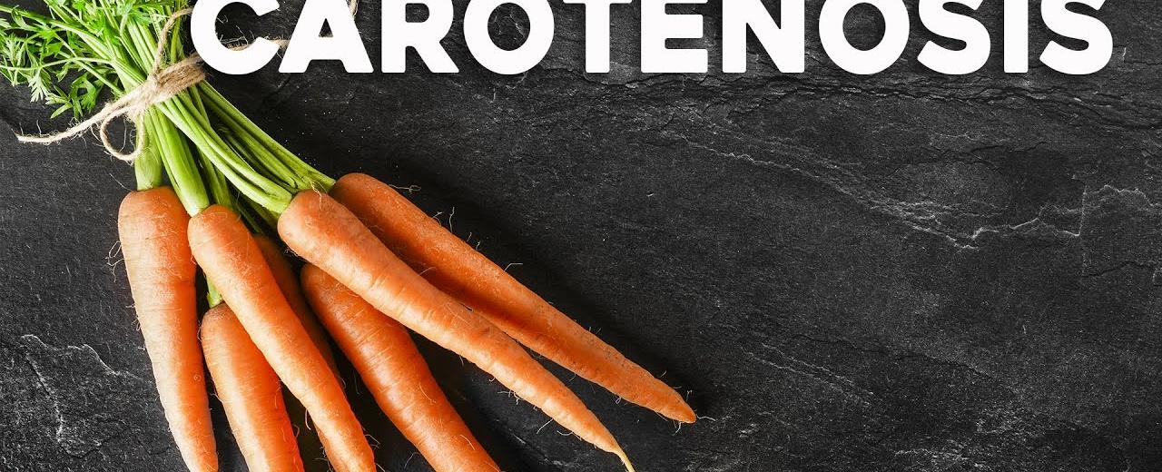 Carrots can turn you orange if you eat several three or more large carrots a day for several weeks the increased beta carotene in your bloodstream can turn your skin orange