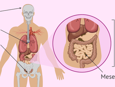 There are certain kinds of tumors that can grow their own teeth and hair they re called teratomas