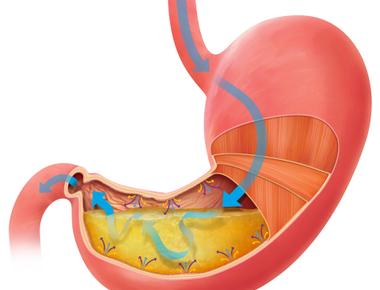 The stomach of an adult can hold 1 5 liters of material