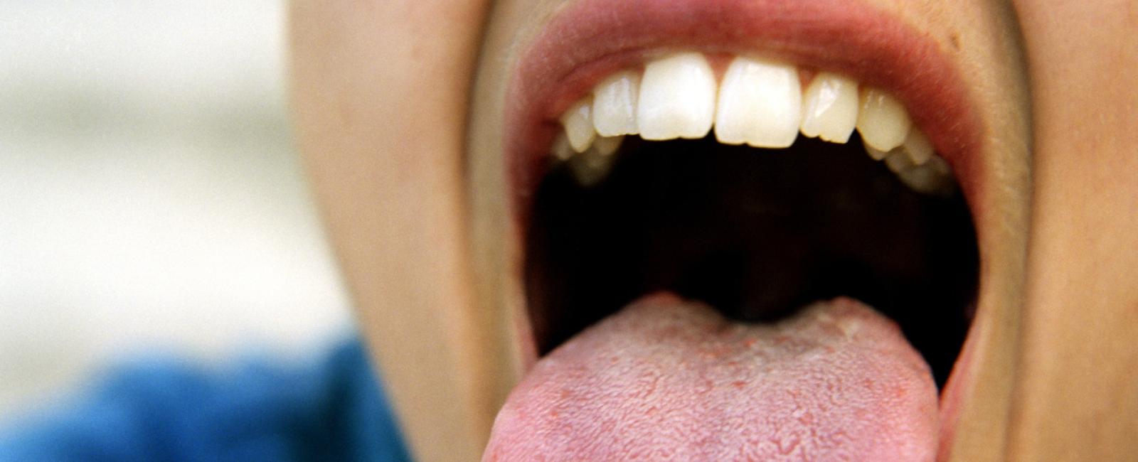 Women have more tastebuds than men