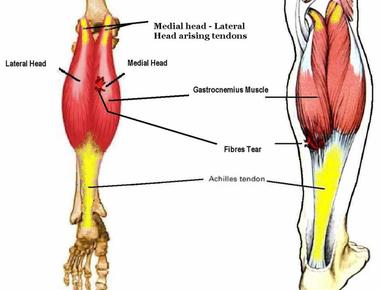 In the human body the muscle which can pull with the most force is the soleus which is found just below the gastrocnemius calf muscle it is vital for walking running and dancing